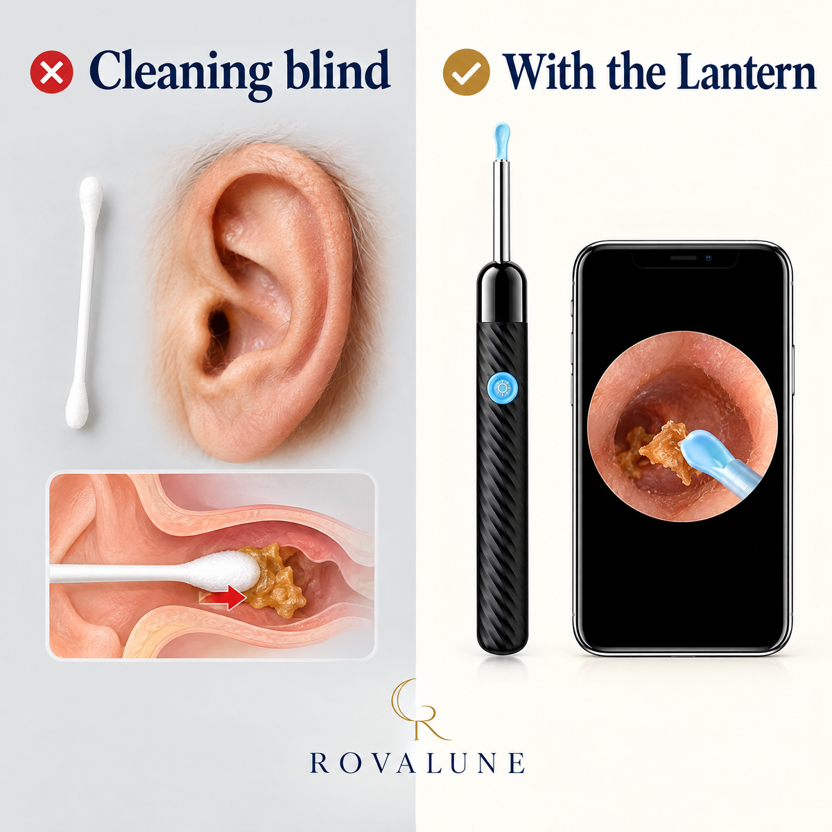 Cotton bud versus Rovalune Lantern